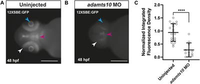 Adamts10 controls transforming growth factor β family signaling that contributes to retinal ganglion cell development